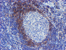 Immunohistochemical staining of paraffin-embedded Human tonsil within the normal limits using anti-SERPINA5 mouse monoclonal antibody