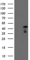 HEK293T cells were transfected with the pCMV6-ENTRY control (Left lane) or pCMV6-ENTRY SERPINA5 (Right lane) cDNA for 48 hrs and lysed