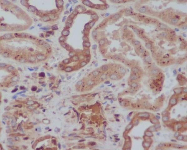 m01917 1 ihc