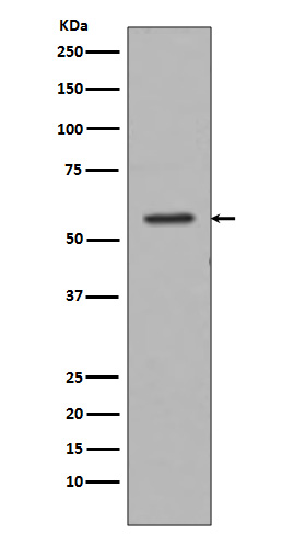 Western blot analysis of Tyrosine Hydroxylase expression in PC-3 cell lysate