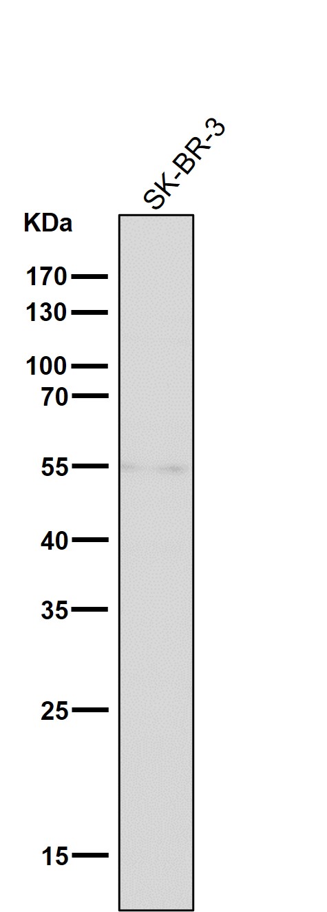 All lanes use the Antibody at 1:1K dilution for 1 hour at room temperature