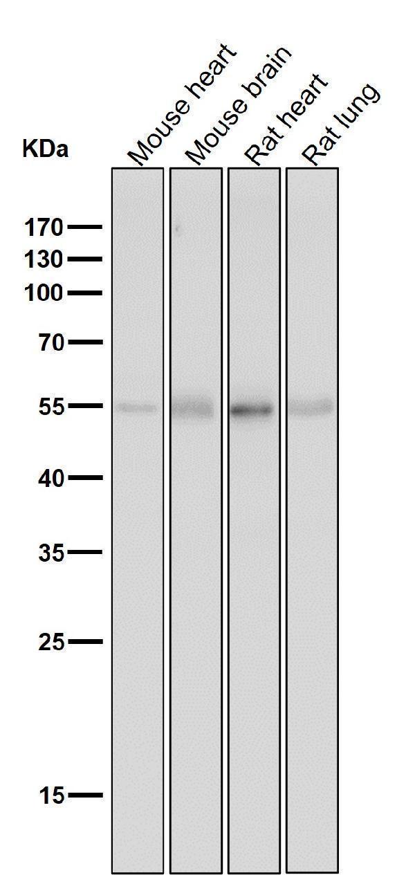 All lanes use the Antibody at 1:1K dilution for 1 hour at room temperature