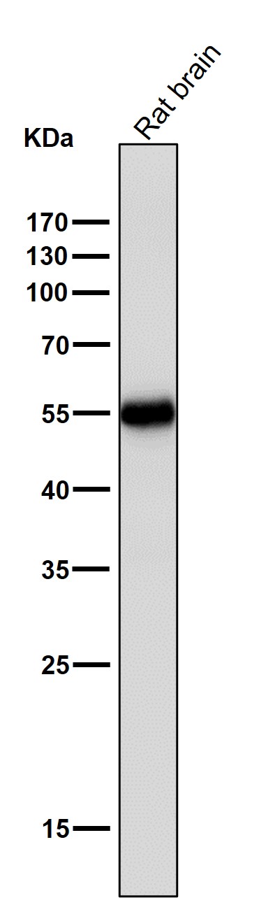 m01917 1 wb8