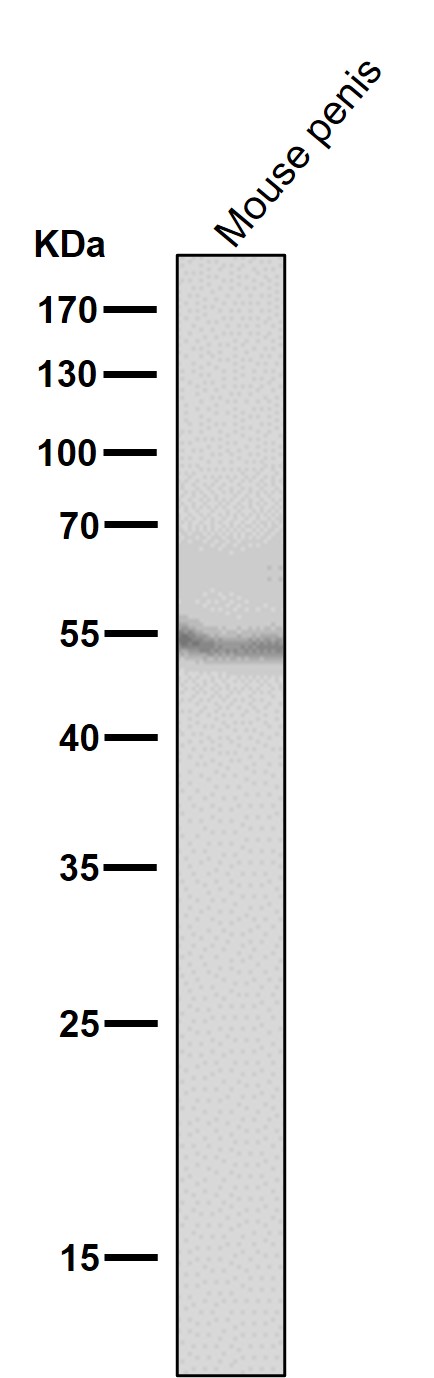 m01917 1 wb9