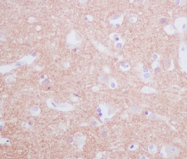 Immunohistochemical analysis of paraffin-embedded human brain, using Tyrosine Hydroxylase Antibody