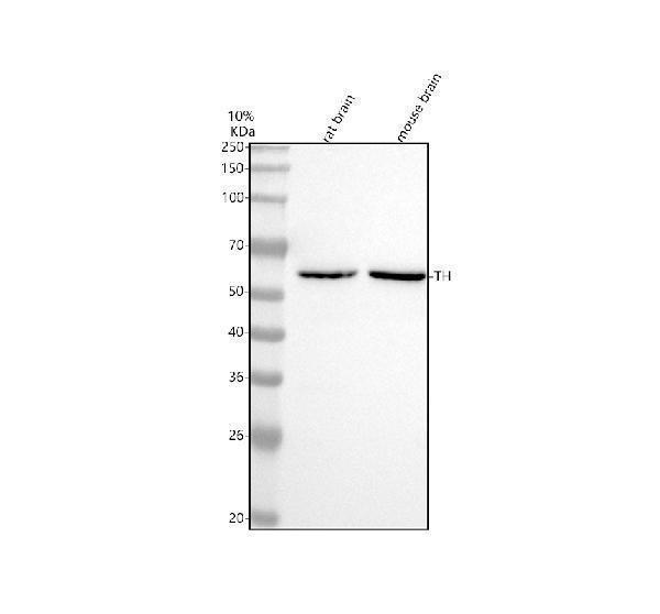  Western blot analysis of TH using anti-TH antibody (M01917)