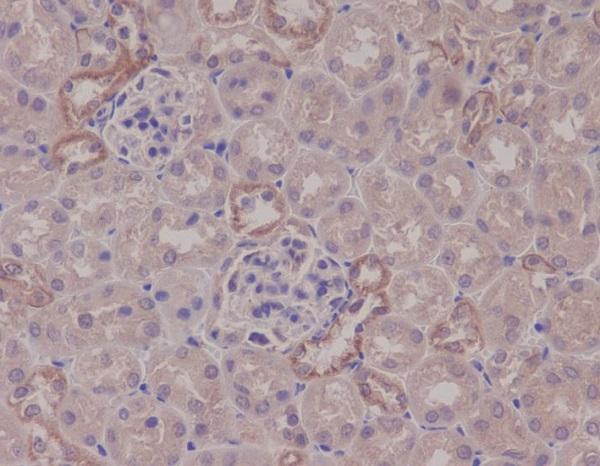 Immunohistochemical analysis of paraffin-embedded mouse kidney, using IKK alpha Antibody
