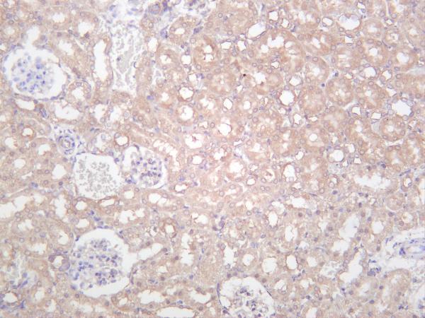 Rat kidney was stained with anti-IKK α rabbit antibody
