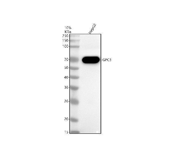 Western blot analysis of GPC3 using anti-GPC3 antibody (M01922-1)