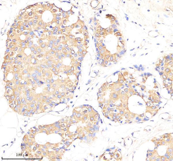  IHC analysis of smc4 using anti-smc4 antibody (M01926)