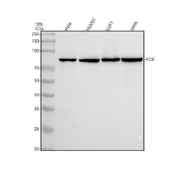  Western blot analysis of Radixin using anti-Radixin antibody (M01926)
