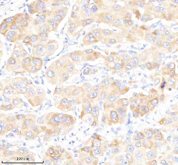  IHC analysis of GABARAPL2 using anti-GABARAPL2 antibody (M01927)