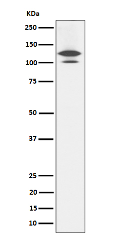 Western blot analysis of RASA1 expression in Rat brain cell lysate
