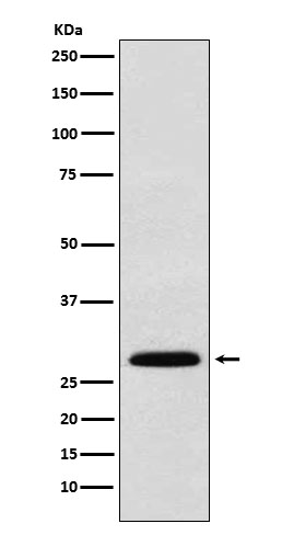 Western blot analysis of KGF expression in 293T cell lysate