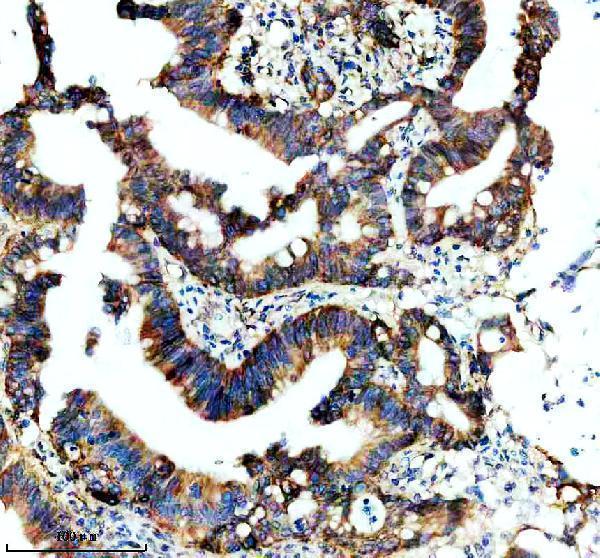 IHC analysis of ITGA2 using anti-ITGA2 antibody (M01933)