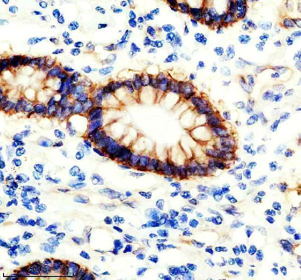 IHC analysis of ITGA2 using anti-ITGA2 antibody (M01933)