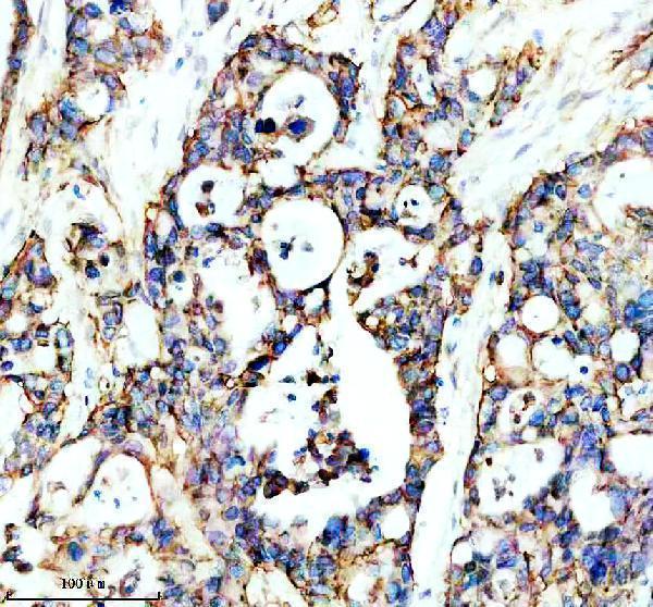 m01933 itga2 primary antibodies ihc testing 3