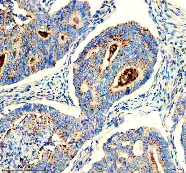 IHC analysis of CHMP2B using anti-CHMP2B antibody (M01935)