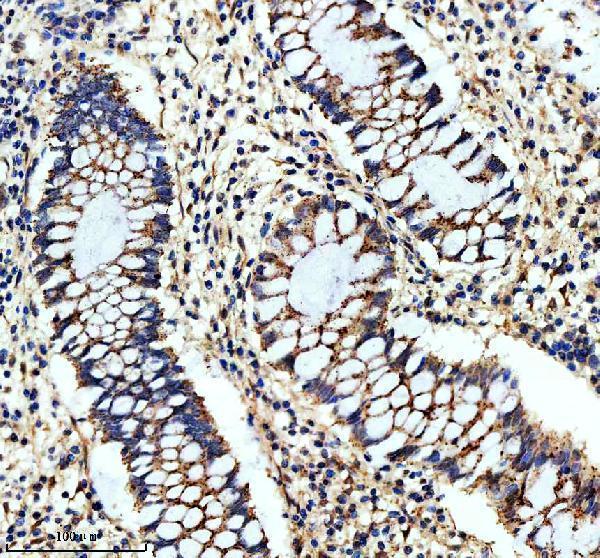 IHC analysis of CHMP2B using anti-CHMP2B antibody (M01935)