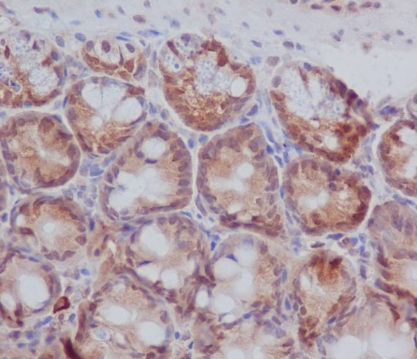 m01940 2 ihc_1