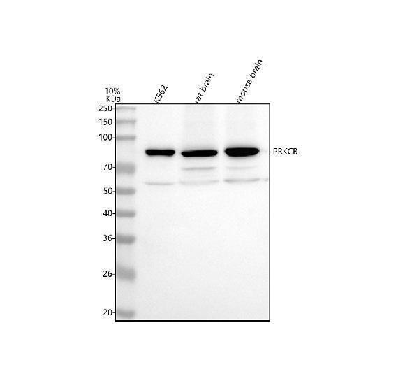 m01940 prkcb primary antibodies wb testing 1