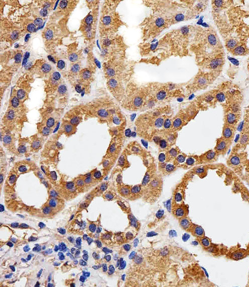 Immunohistochemical analysis of paraffin-embedded H