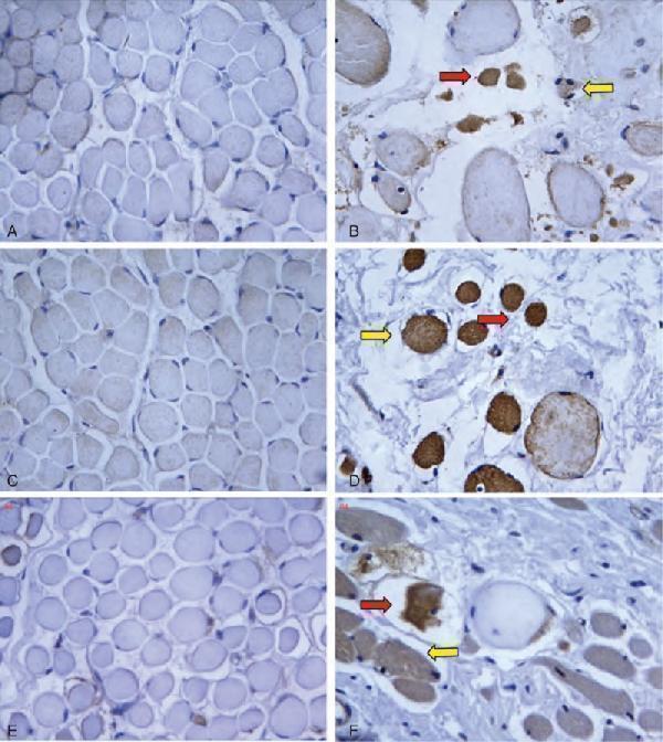 The sections obtained from muscles of controls (13 months’ old) and 2-year-old patients with CMT