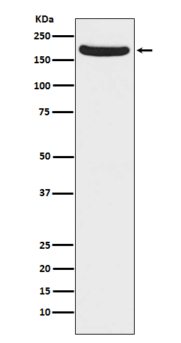 Western blot analysis of NMDAR2A expression in mouse brain lysate