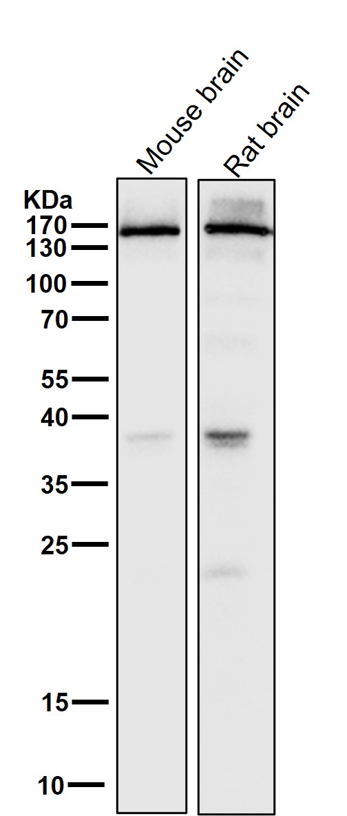 All lanes use the Antibody at 1:5K dilution for 1 hour at room temperature