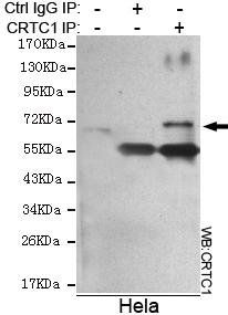 m01951 crtc1 primary antiboties ip testing 4
