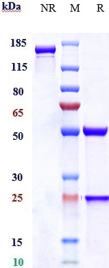 Anti-SLC40A1 Reference Antibody (Amgen patent anti-Ferroportin) on SDS-PAGE under reducing (R) condition