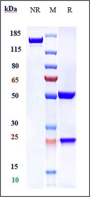Anti-SLC40A1 Reference Antibody (LY2928057) on SDS-PAGE under reducing (R) condition