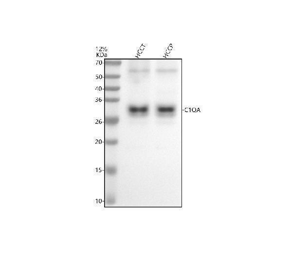 Western blot analysis of C1QA using anti-C1QA antibody (M01955)