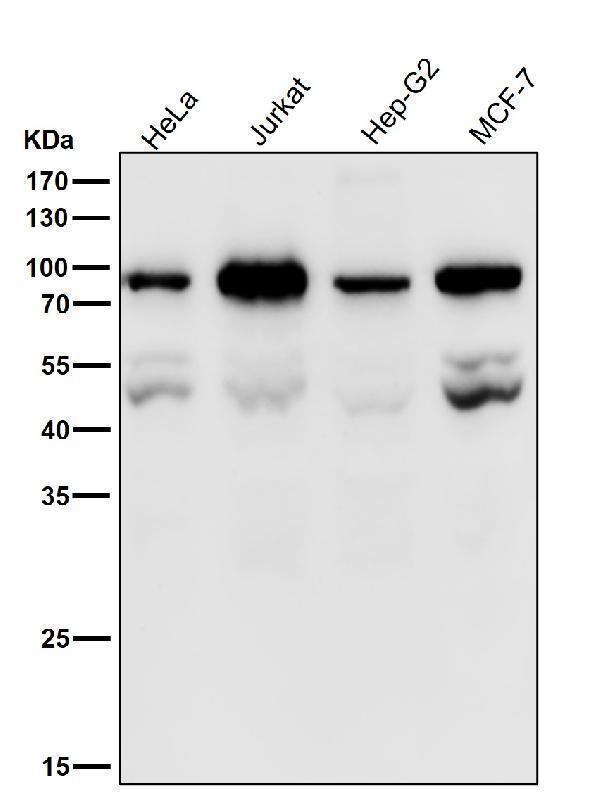 All lanes use the Antibody at 1:1W dilution for 1 hour at room temperature