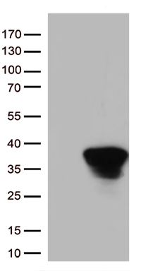 HEK293T cells were transfected with the pCMV6-ENTRY control (Left lane) or pCMV6-ENTRY STX1A (Right lane) cDNA for 48 hrs and lysed