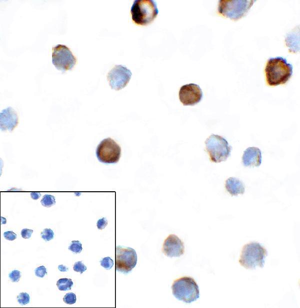 Immunocytochemistry of TIGIT in over expressing HEK293 cells using TIGIT antibody and control mouse IgG antibody (left corner box) at 1 μg/ml