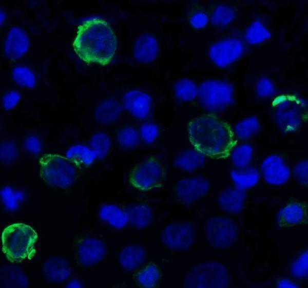 Immunofluorescence of TIGIT in over expressing HEK293 cells using TIGIT Antibody at 1 μg/ml