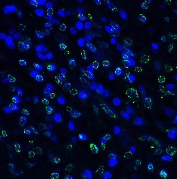 m01962 1 tigit primary antibodies if testing 4