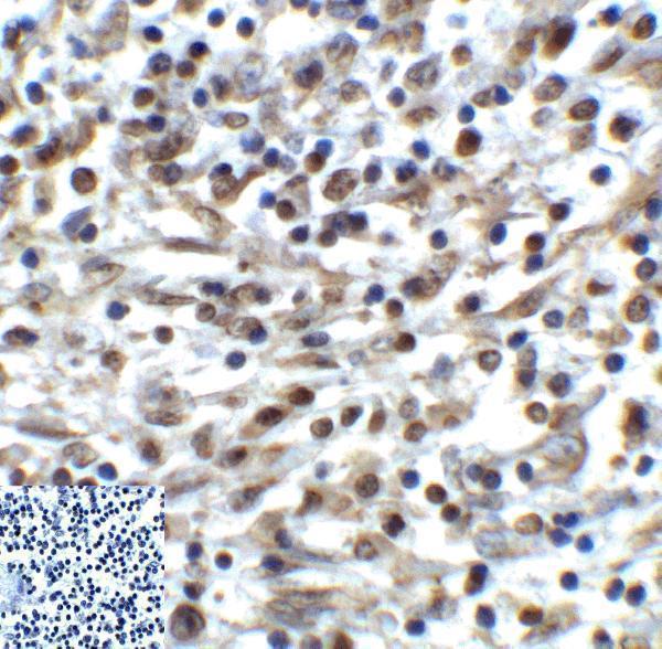 m01962 1 tigit primary antibodies ihc testing 5
