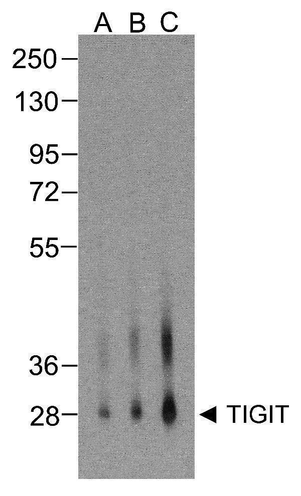 Western blot analysis of TIGIT in over expressing HEK293 cells using M01962-1 antibody at (A) 0