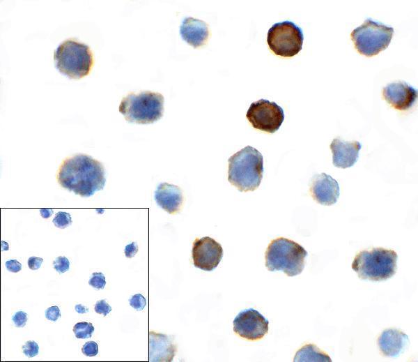 Immunocytochemistry of TIGIT in over expressing HEK293 cells using TIGIT antibody and control mouse IgG antibody (left corner box) at 1 μg/ml