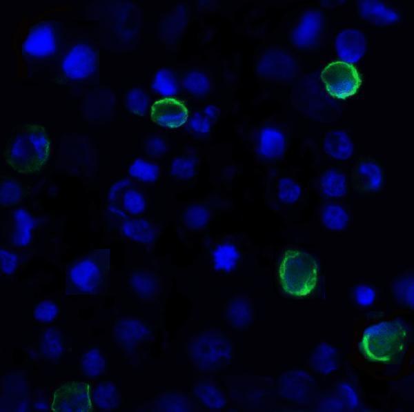 Immunofluorescence of TIGIT in over expressing HEK293 cells using TIGIT Antibody at 1 μg/ml
