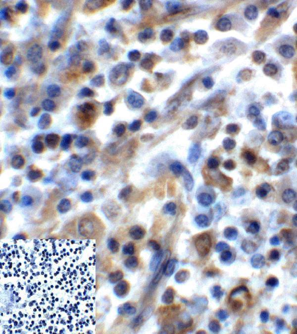 m01962 tigit primary antibodies ihc testing 4