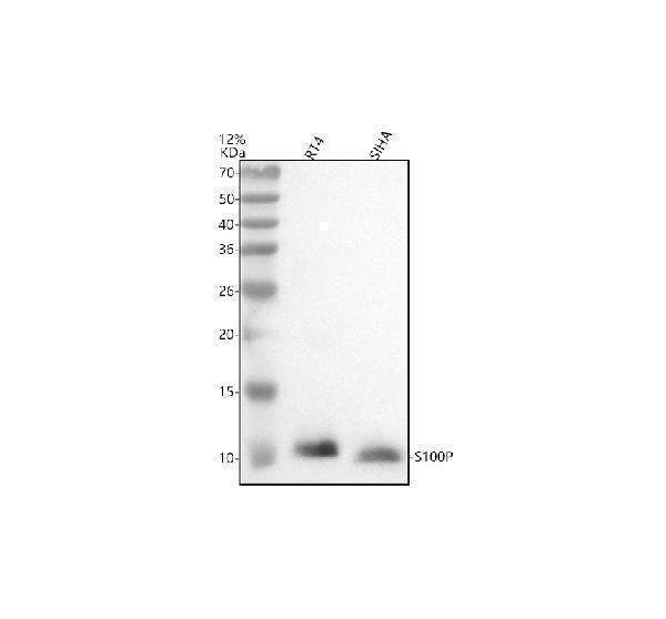 Western blot analysis of S100P using anti-S100P antibody (M01963)