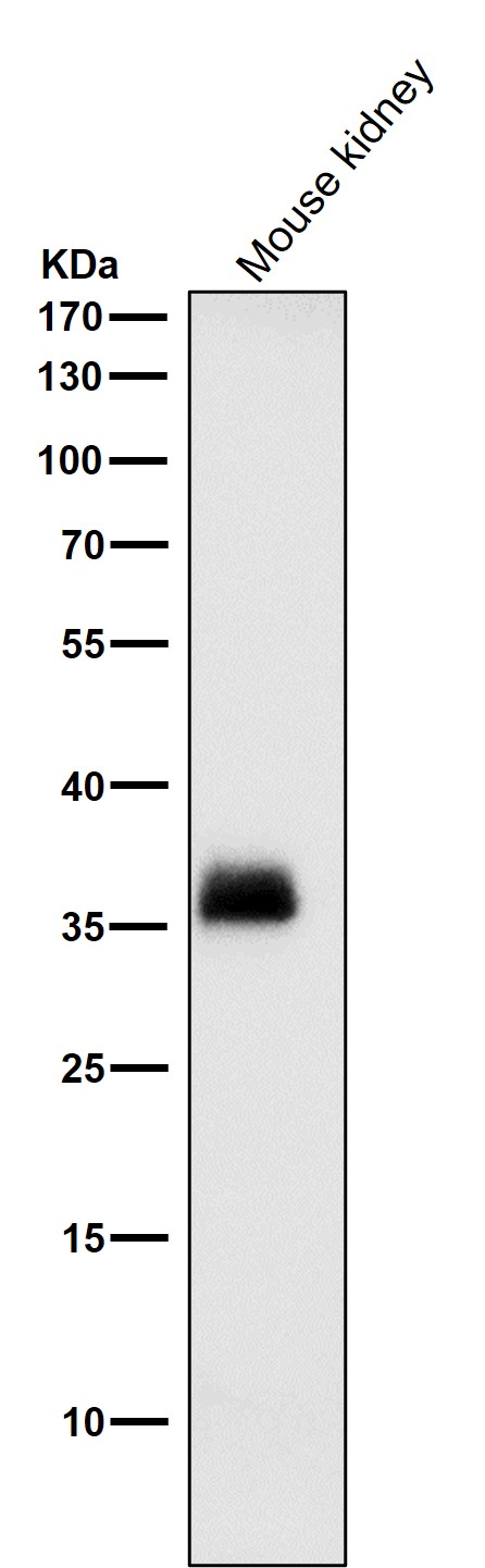 All lanes use the Antibody at 1:1K dilution for 1 hour at room temperature