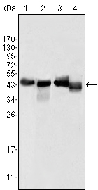 Western blotting validation for Anti-ApoA-IV APOA4 Monoclonal Antibody M01973
Western Blot (WB) analysis using ApoA-IV Monoclonal Antibody against Human Serum (1)