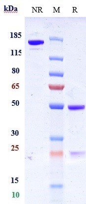Anti-CD7 Reference Antibody (grisnilimAb) on SDS-PAGE under reducing (R) condition