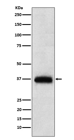 Western blot analysis of CD7 expression in human PBMC lysate