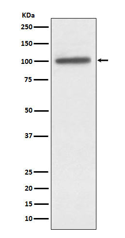 Western blot analysis of alpha Actinin 4 expression in A431 cell lysate