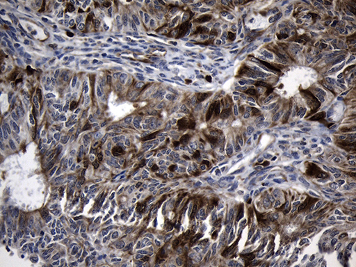 m01978 1 anti rrm2 mouse monoclonal antibody clone id oti3d3 ihc testing 5
